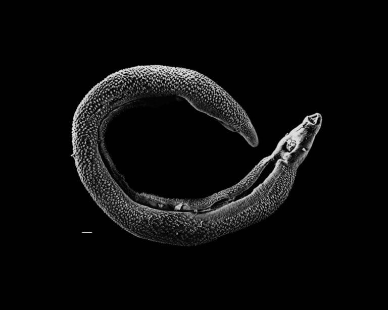 image of parasitic worm.