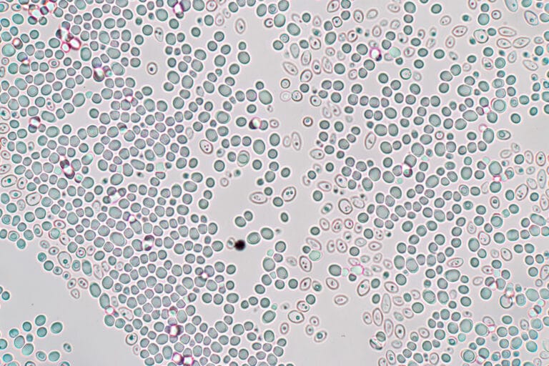 Budding yeast cell under the microscope.
