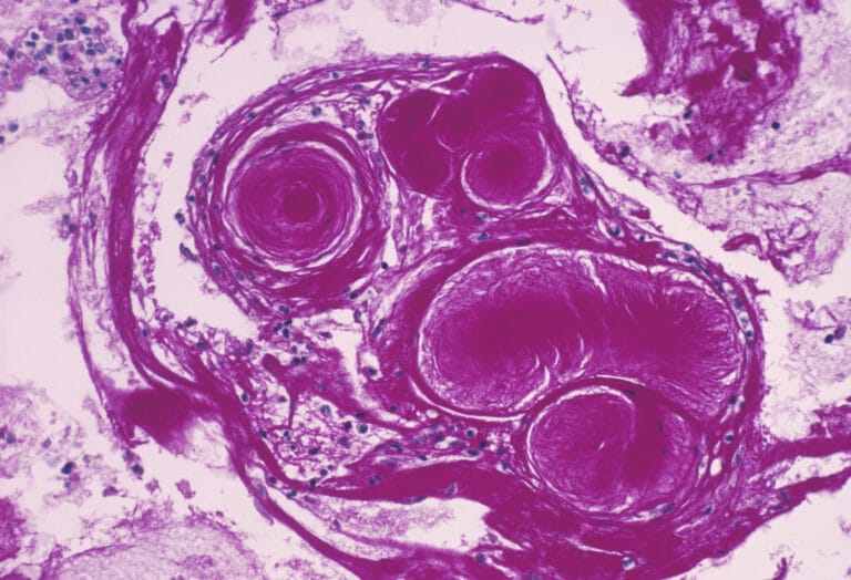 protein called the cystic fibrosis transmembrane conductance regulator
