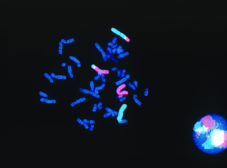 FISH micrograph of chromosome