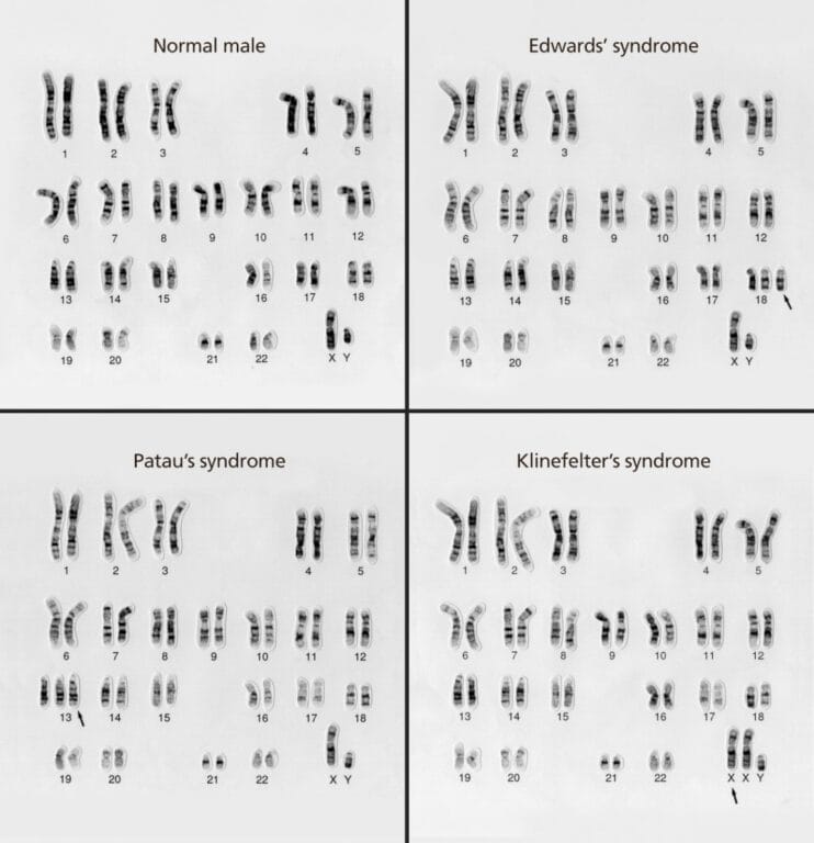 Cytology. Cytology. Figure 7-4. Photomicrograph Showing Relational Coiling  in the B, D, and E Chromosomes of a Giant Microspore of Trillium  grandiflorum with Nine Chromosomes. (From Sparrow, A. H., Huskins, C. L.,