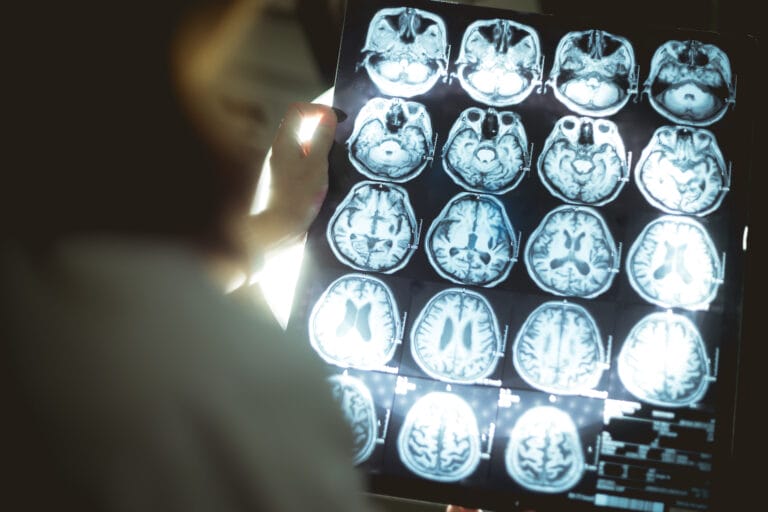 brain scan images looking for dementia