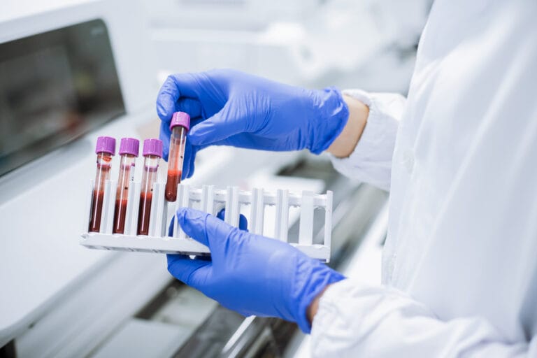 Scientist wear glove holding test tube in sample rack