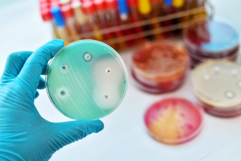 Antimicrobial susceptibility testing in petri dish.