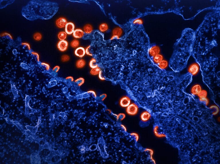 Illustration of the HIV Virus