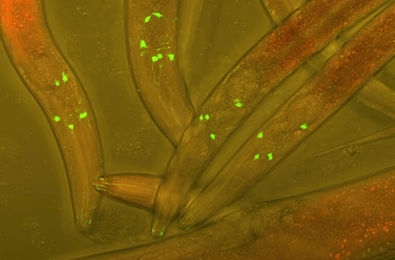 Picture of a nemotode worm