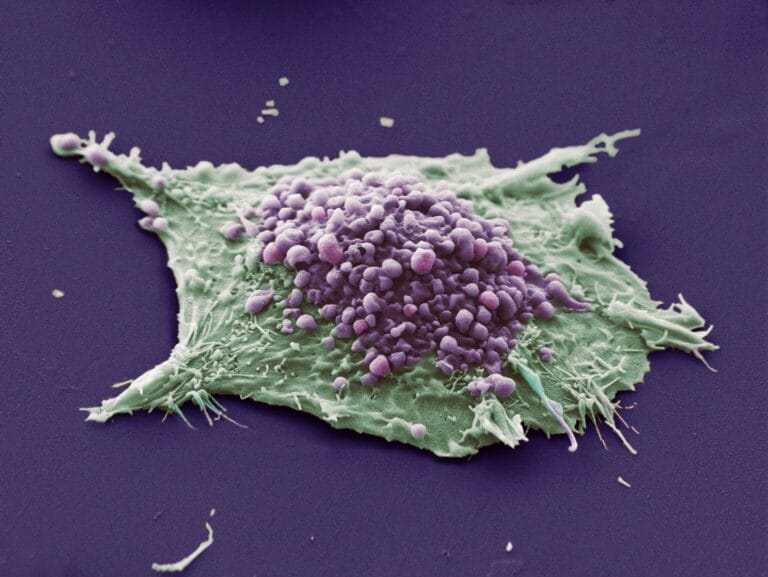 3d illustration of Uncontrolled cell growth