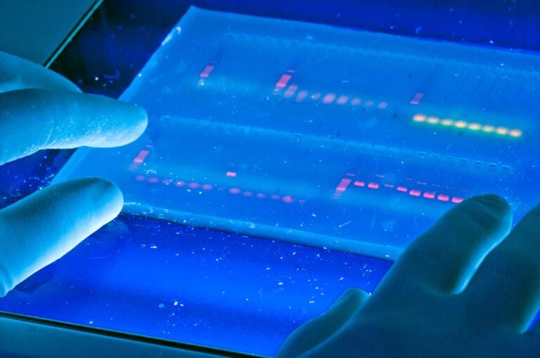 Agarose gel with UV illumination - Ethidium bromide stained DNA glows orange