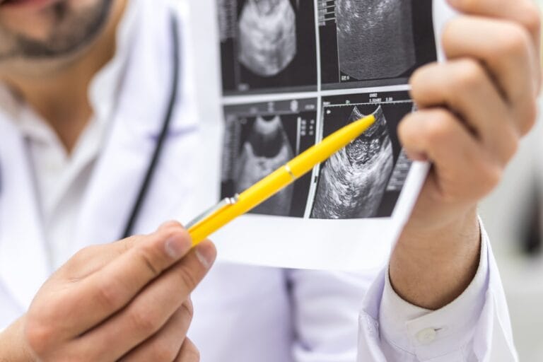Doctors and other health care professionals will explain what genetic test results mean for a patient or their baby, even before that baby is born. Picture is oof a male doctor showing a baby scan image, pointing at it with a pen.