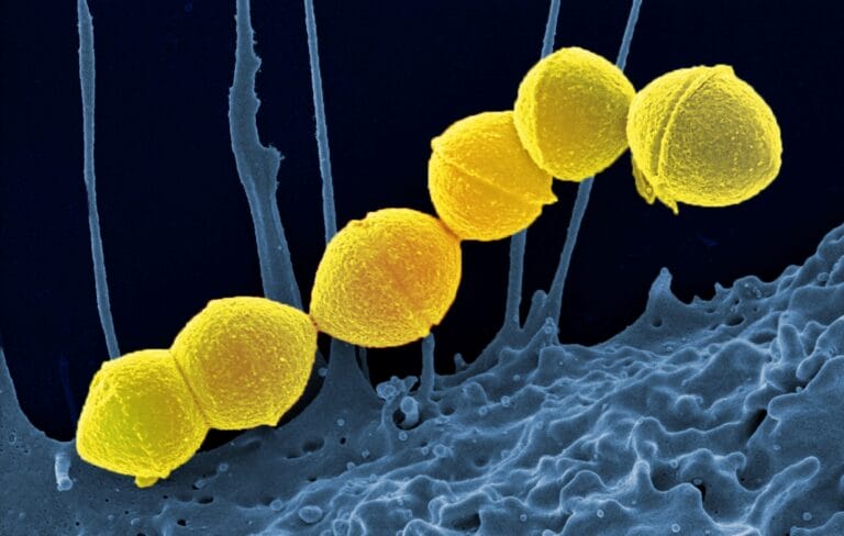 graphic of bacteria Streptococcus