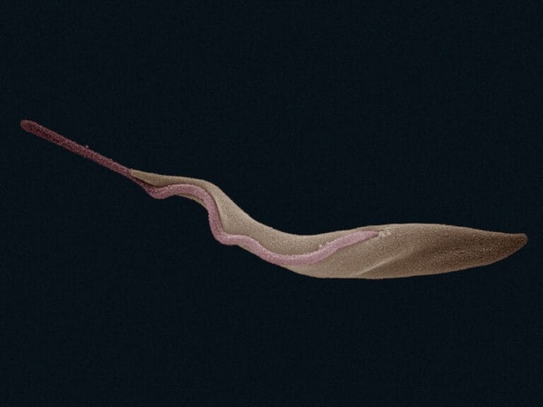 Image of the Trypanosoma brucei parasite that causes African sleeping sickness.