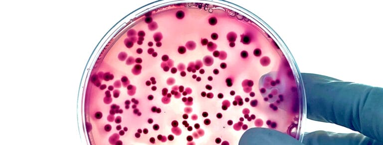 Bacterial Artificial Chromosome (BAC) libraries