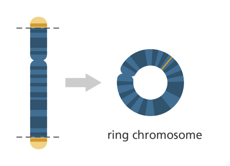 A chromosome on the left with the ends coloured yellow. On the right the chromosome has lost these yellow ends and has curled over to form a complete ring.